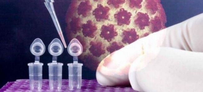 HPV diagnostika digene testi abil
